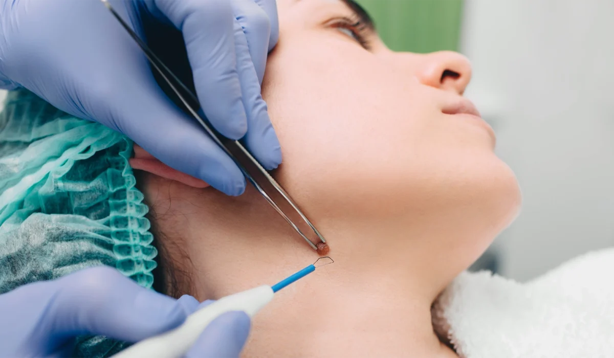 endoskopik baş boyun